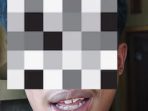 b1